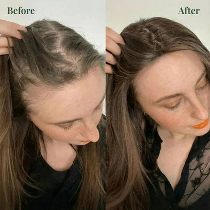 Kerarose Rosemary Shampoo For Hair Growth (MALE & FEMALE)