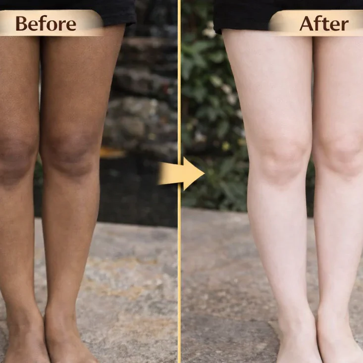 Glowvera™ Body Cream | Buy 1 Get 1 Free
